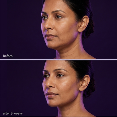 The Lift - Neck & Jawline Sculpt Crème