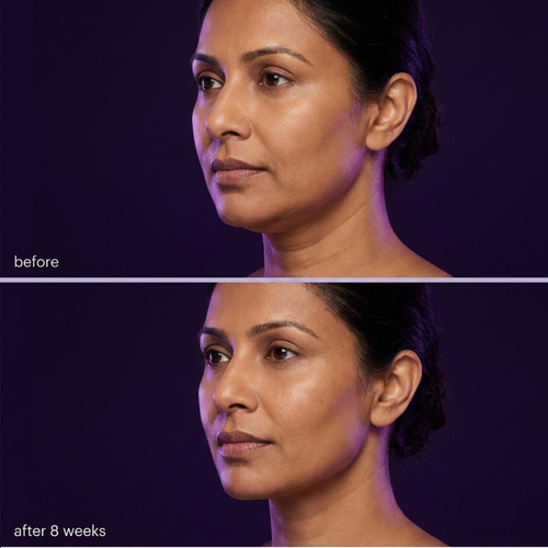 The Lift - Neck & Jawline Sculpt Crème