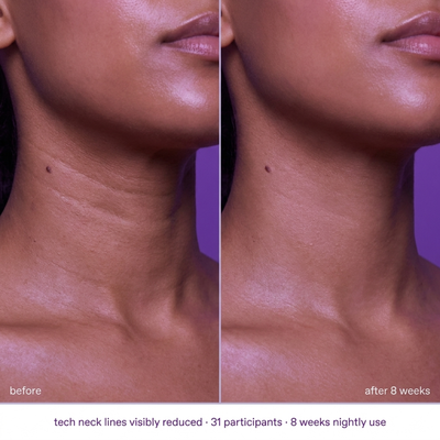 The Lift - Neck & Jawline Sculpt Crème