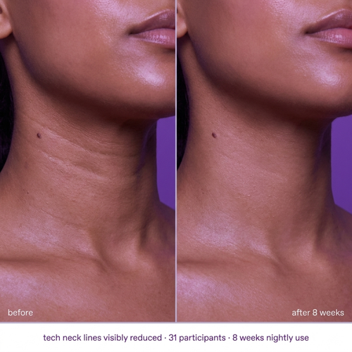 The Lift - Neck & Jawline Sculpt Crème